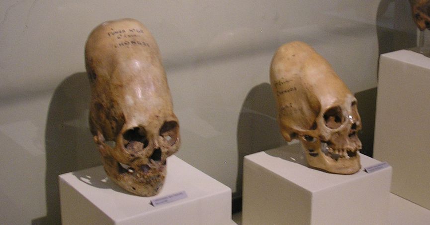 Name:  elongated human skulls.jpg
Views: 1374
Size:  44.1 KB
