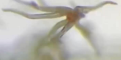 aluminum nerve overlay.png
